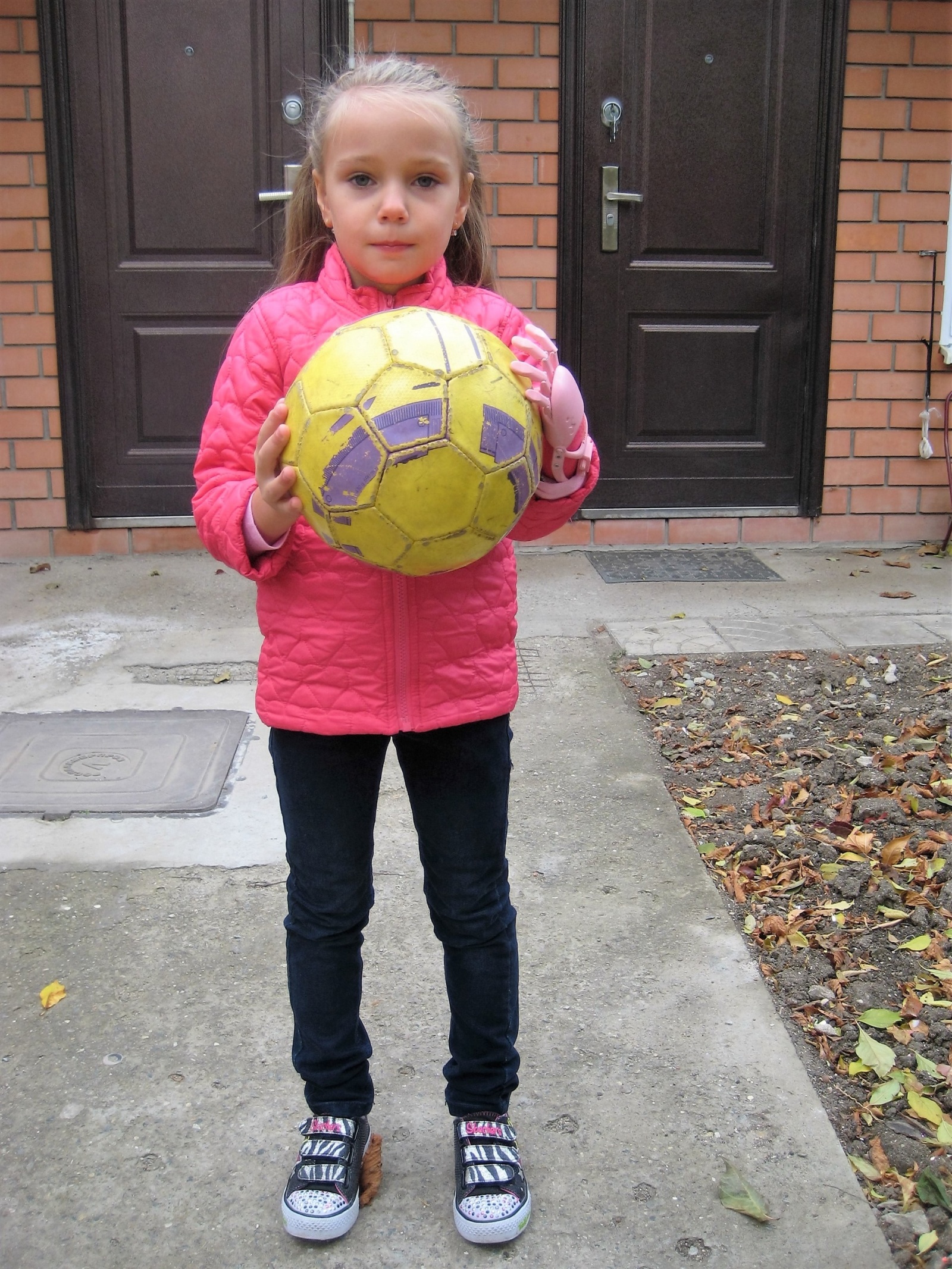 Как «Моторика» делает протезы для детей - 14 Как «Моторика» делает протезы для детей - 14