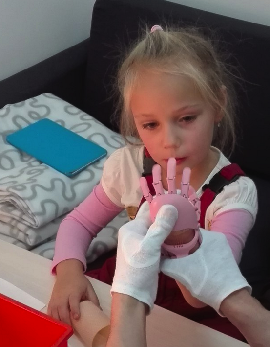 Как «Моторика» делает протезы для детей - 15 image