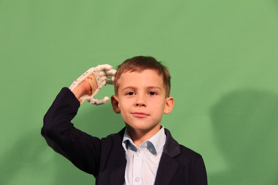 Как «Моторика» делает протезы для детей - 16 Как «Моторика» делает протезы для детей - 16