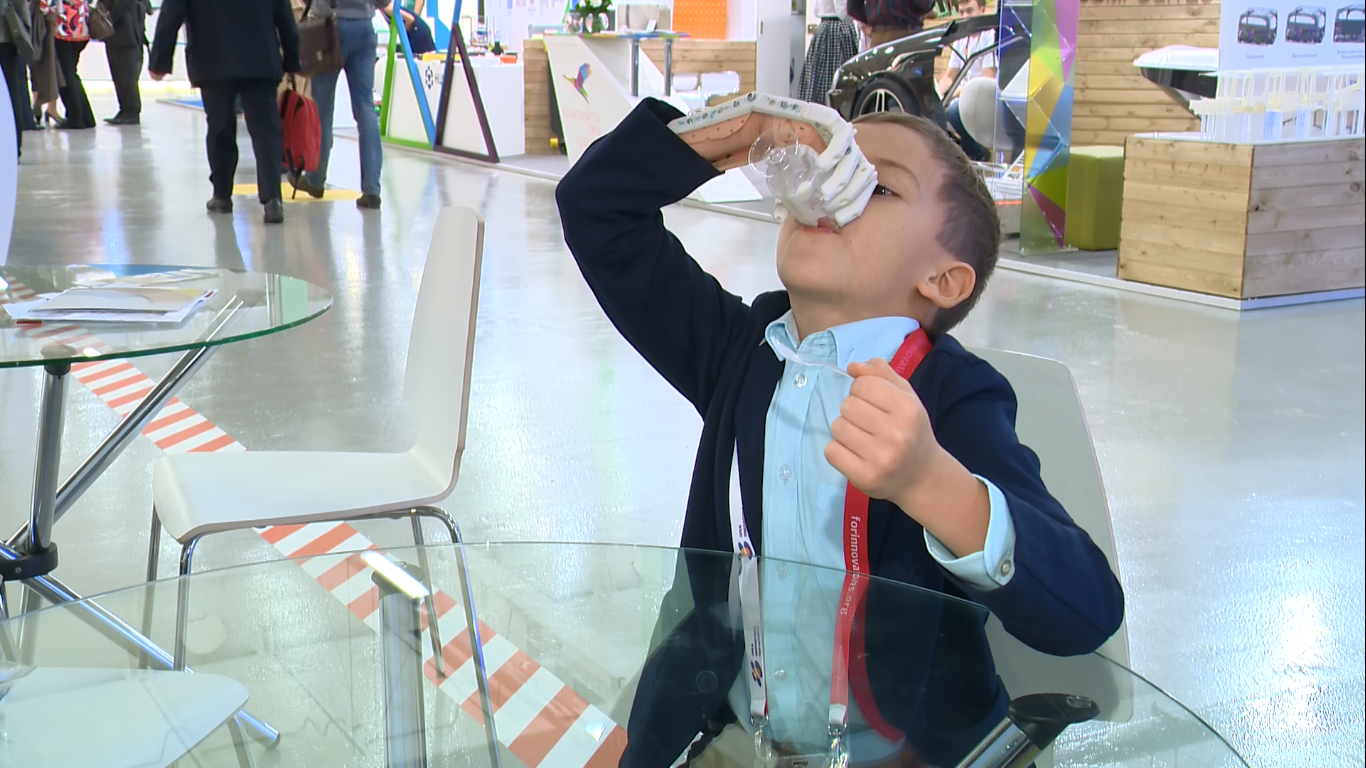 Как «Моторика» делает протезы для детей - 17 Как «Моторика» делает протезы для детей - 17