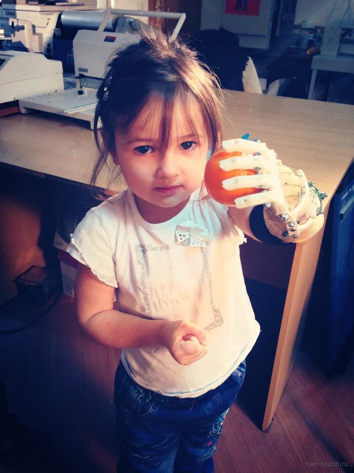 Как «Моторика» делает протезы для детей - 18 Как «Моторика» делает протезы для детей - 18