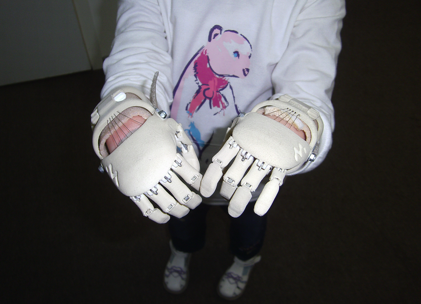 Как «Моторика» делает протезы для детей - 19 image