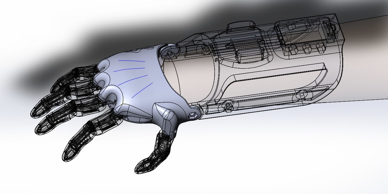 Как «Моторика» делает протезы для детей - 4 Как «Моторика» делает протезы для детей - 4