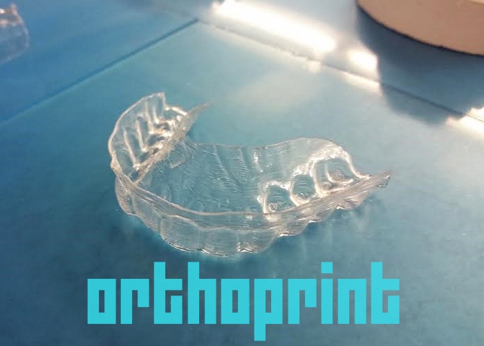Сам себе стоматолог: американский студент исправил прикус при помощи 3D печати - 1