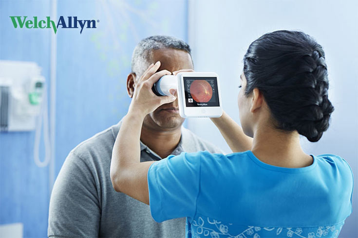 Небольшое устройство Welch Allyn RetinaVue 100 Imager позволяет своевременно диагностировать диабетическую ретинопатию - 1