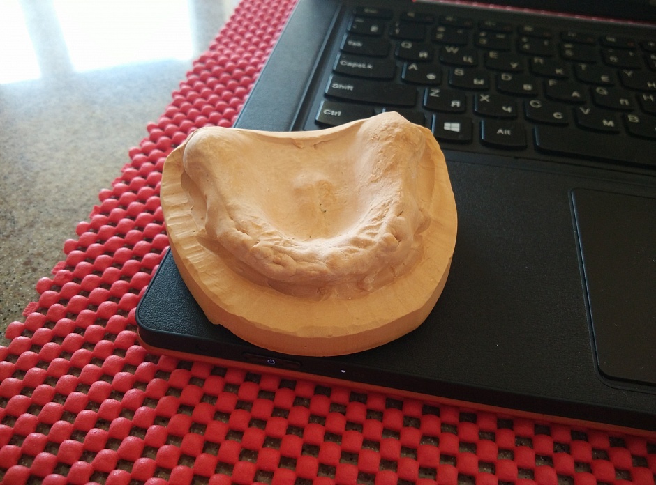 Применение 3D принтера в стоматологии - 2