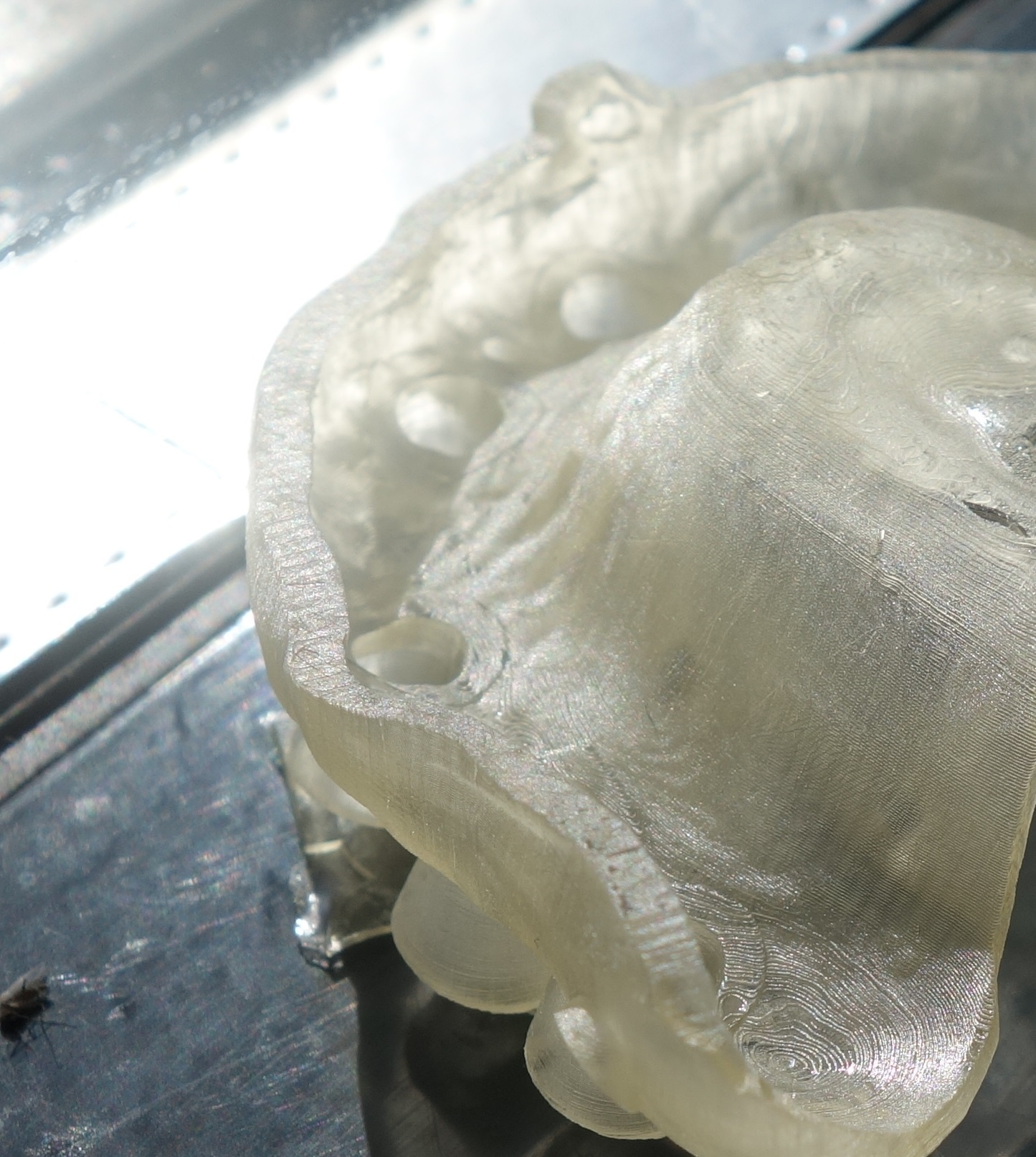 Применение 3D принтера в стоматологии - 5