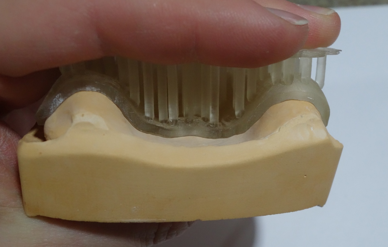 Применение 3D принтера в стоматологии - 7