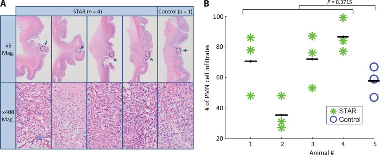 Автономный робот-хирург провёл операцию на мягких тканях почти без помощи человека - 4 Автономный робот-хирург провёл операцию на мягких тканях почти без помощи человека - 4