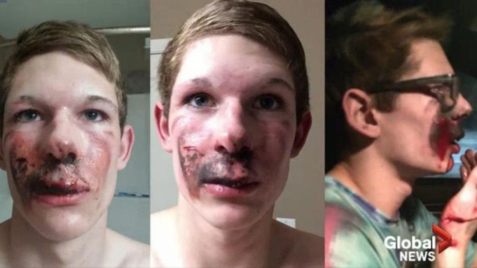 Курение наносит тяжкие телесные повреждения: взрыв электронной сигареты может лишить человека глаза, зубов или ноги - 8 image