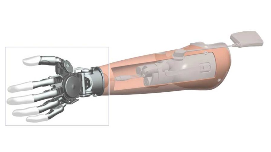 Обзор рынка бионических рук на 2016 год: что можно купить в России - 6 Обзор рынка бионических рук на 2016 год: что можно купить в России - 6