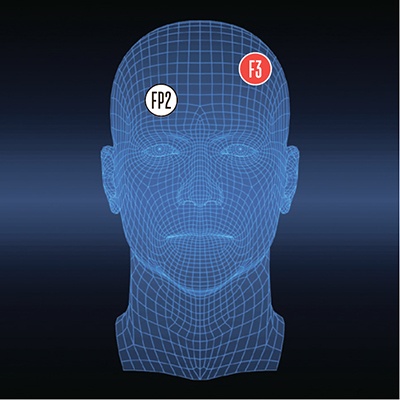 Биохакинг мозга: куда располагать электроды, чтобы стать умнее? - 10 Биохакинг мозга: куда располагать электроды, чтобы стать умнее? - 10