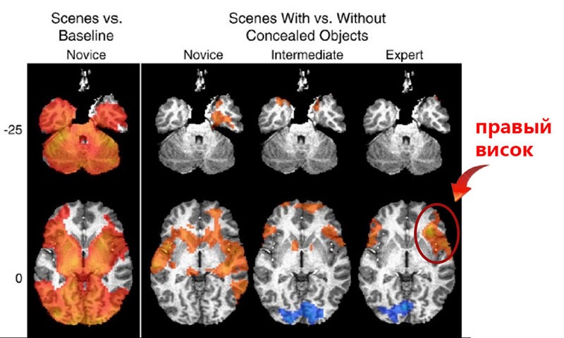 Биохакинг мозга: куда располагать электроды, чтобы стать умнее? - 4 Биохакинг мозга: куда располагать электроды, чтобы стать умнее? - 4