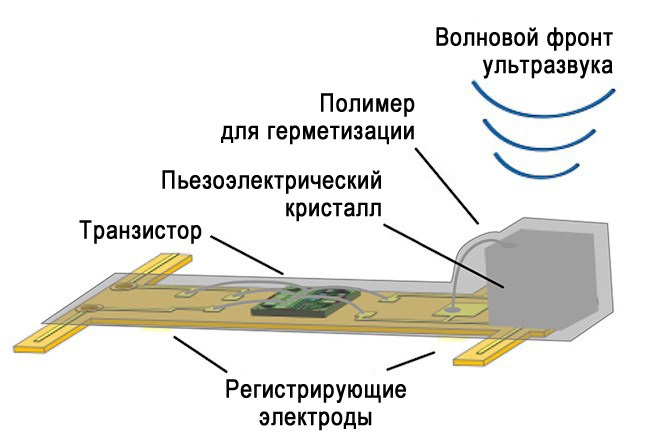 «Нейронная пыль»: крошечные беспроводные импланты работают как электронные медикаменты для мозга - 2