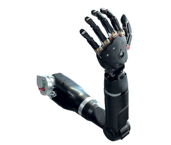 Потерявшая руку женщина получила один из самых совершенных бионических протезов в мире - 1