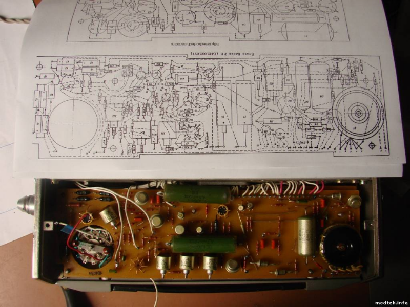 Эволюция кардиографов: от комнат с солевыми ваннами к чехлам для iPhone - 6 Эволюция кардиографов: от комнат с солевыми ваннами к чехлам для iPhone - 6
