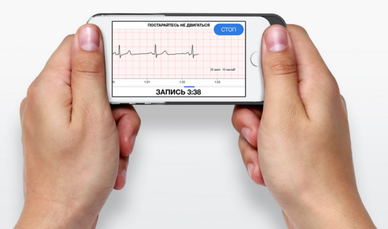 Эволюция кардиографов: от комнат с солевыми ваннами к чехлам для iPhone - 8