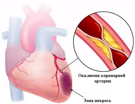 Стволовые клетки позволяют приводить в порядок больное сердце обезьян - 2