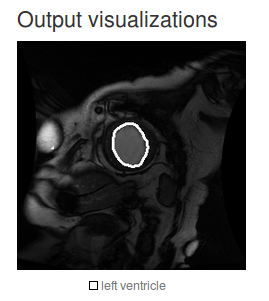 Как стать супер-мега-про машинного обучения за 15 минут - 11 image