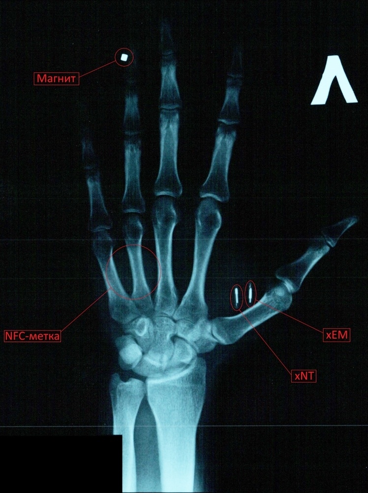 Мой опыт биохакинга. Часть 1: RFID - 2