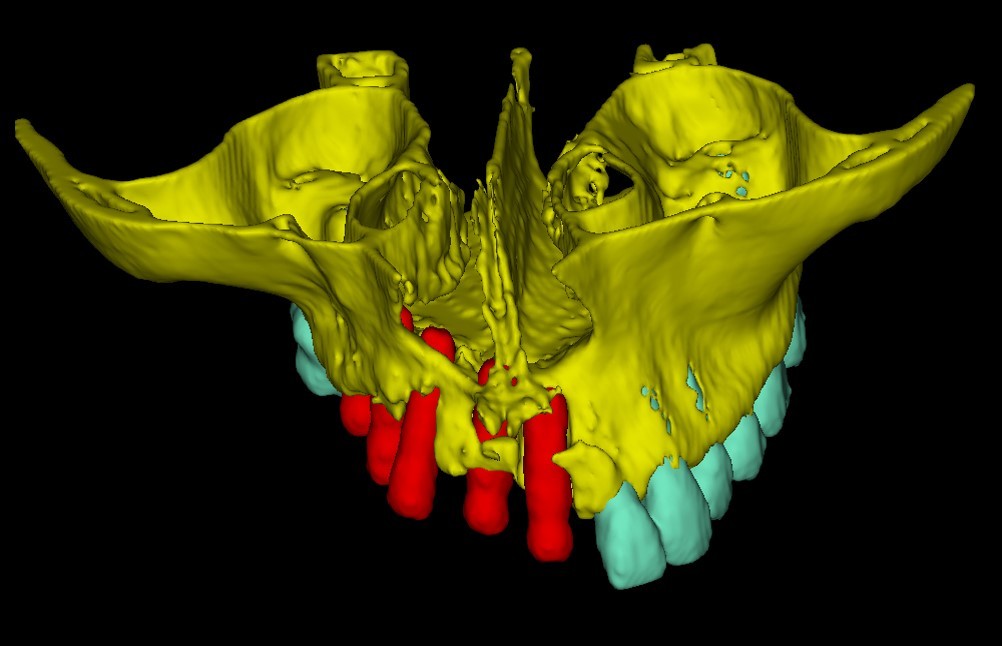 Применение 3D-технологий в стоматологии - 16