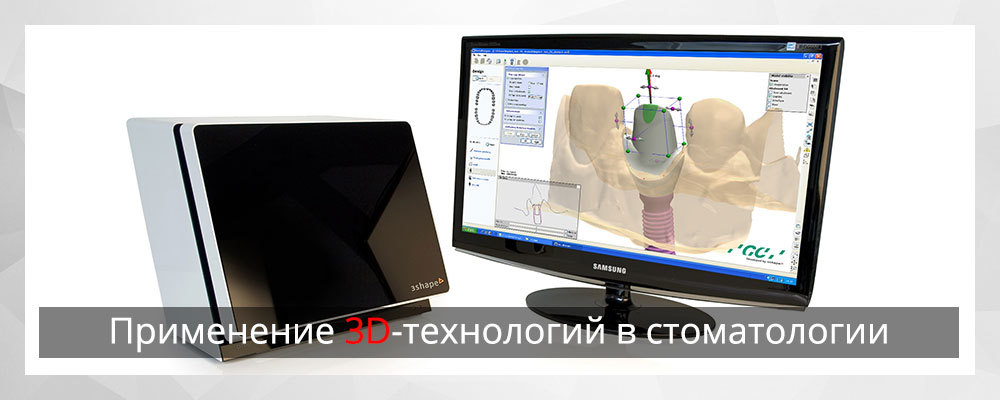 Применение 3D-технологий в стоматологии - 1