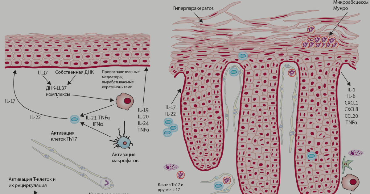 В журнале группы Nature вышла статья российских ученых о генетических факторах развития псориаза - 1