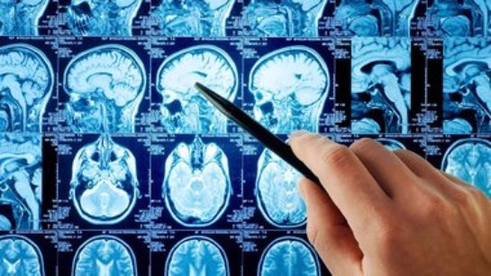 В головном мозге обнаружили не известный раннее тип иммунных клеток В головном мозге обнаружили не известный раннее тип иммунных клеток