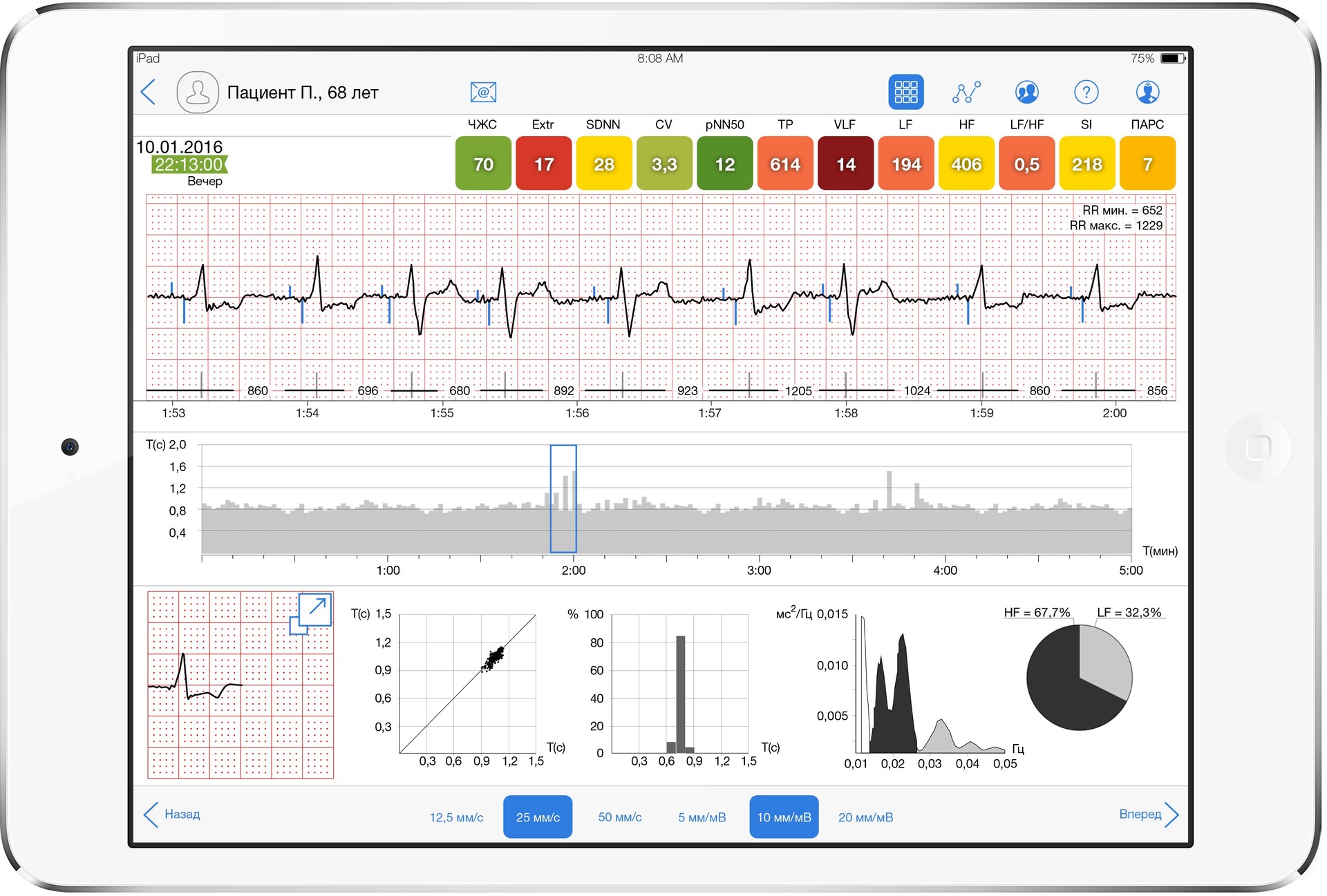 Об использовании когнитивной системы IBM Watson Analytics для анализа данных о работе сердца - 2