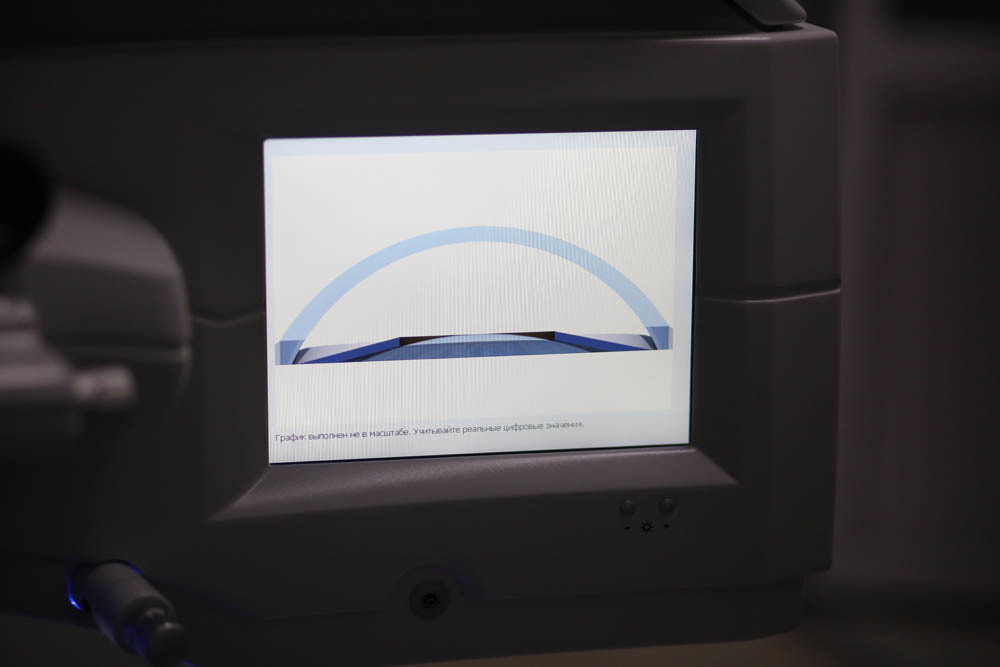 Оборудование операционной для коррекции зрения - 67 Оборудование операционной для коррекции зрения - 67