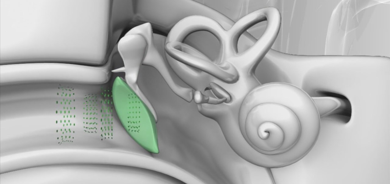 От физиологии до гаджета: наушники, которые адаптируют звук к ушам – амбициозный стартап Nura - 4