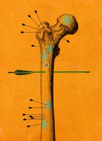 Сильно болит? Как современная медицина пытается избавить нас от боли - 4 image