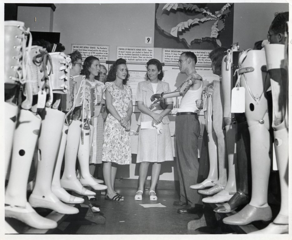 История имплантируемой техники. Протезы конечностей - 11 image