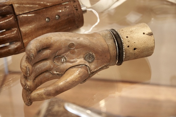 История имплантируемой техники. Протезы конечностей - 4 image