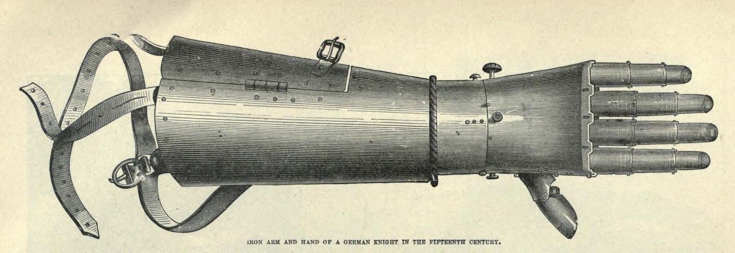 История имплантируемой техники. Протезы конечностей - 6 image