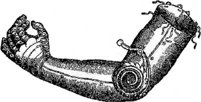 История имплантируемой техники. Протезы конечностей - 7 image