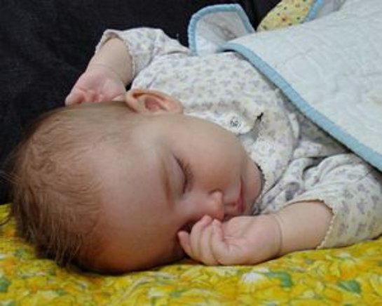 Ученые рассказали, чем опасен синдром плоской головы у младенцев
