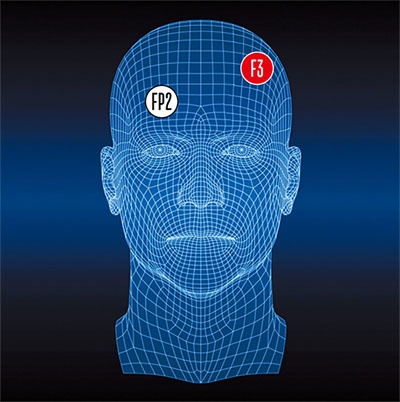 Может ли электростимуляция мозга заменить антидепрессанты и помочь от стресса? - 2