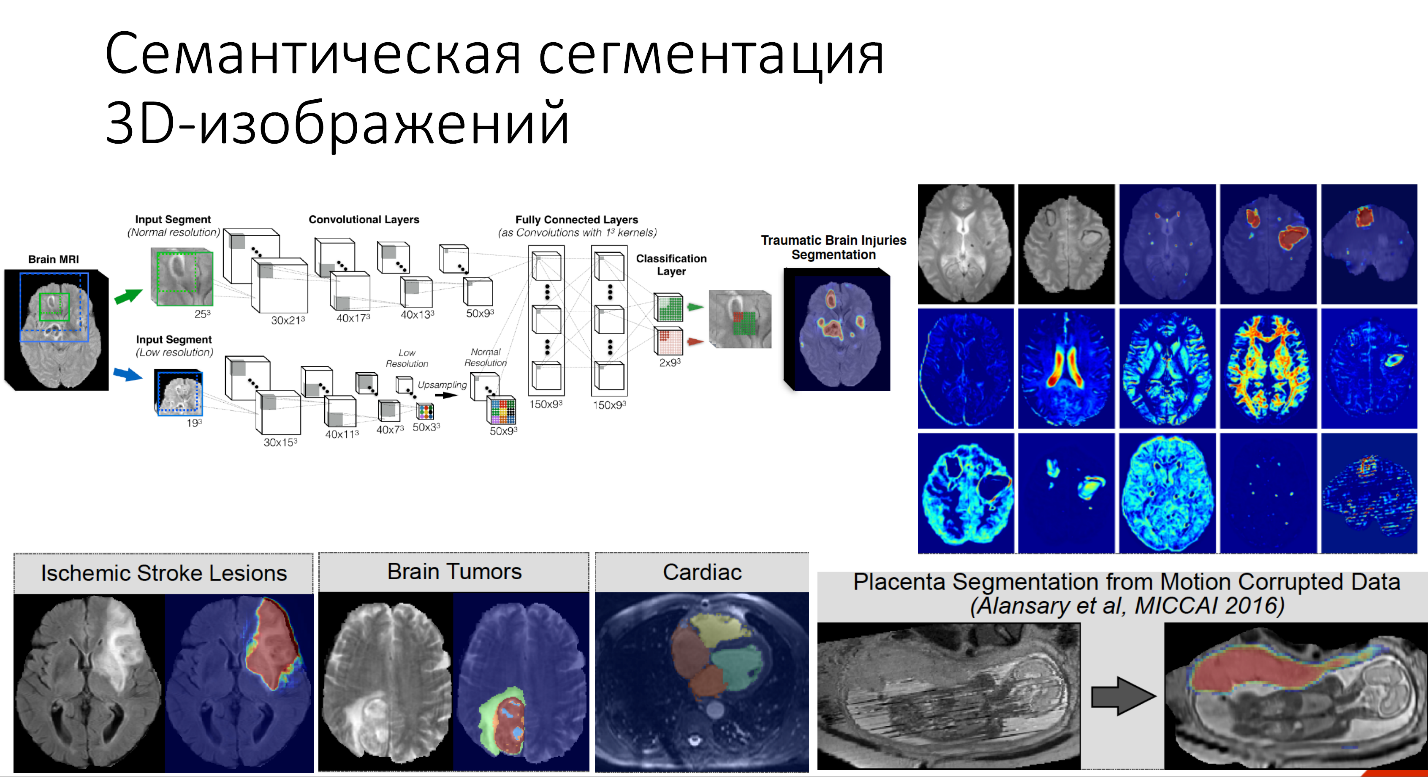 Нейронные сети: практическое применение - 18