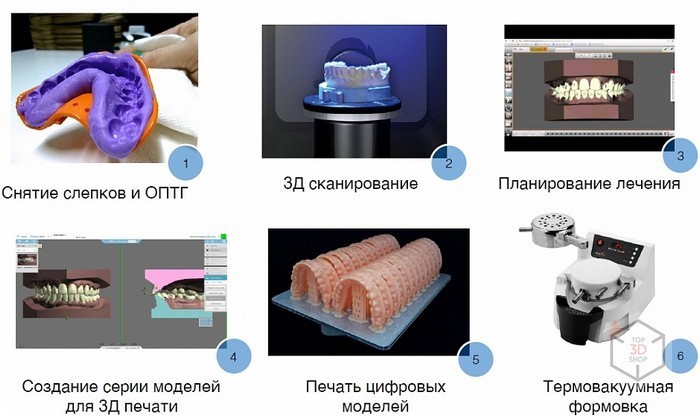 Как мы тестировали исправление прикуса элайнерами на нашем директоре - 11