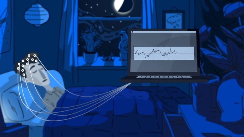 Как управлять сном: методы прямого воздействия на активность мозга - 4 image