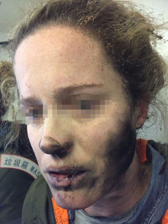 Беспроводные наушники взорвались на голове девушки во время авиаперелёта