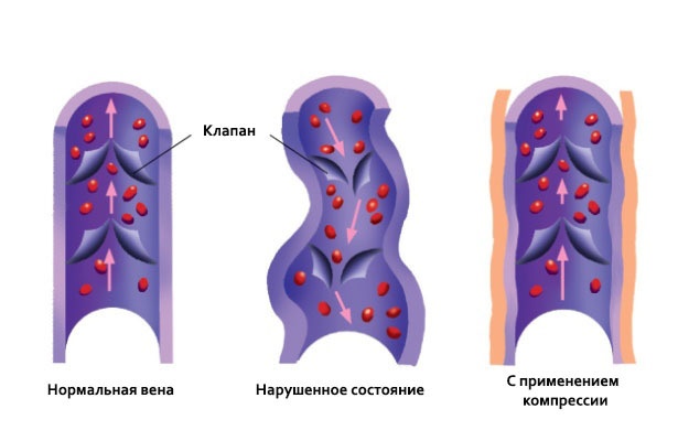 Почему с кардио-футболкой лучше, чем без нее: пару слов про умную одежду - 13