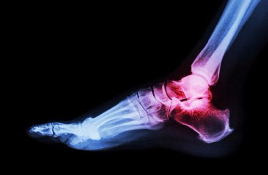 10 мутантных генов, которые сделают вас сверхчеловеком