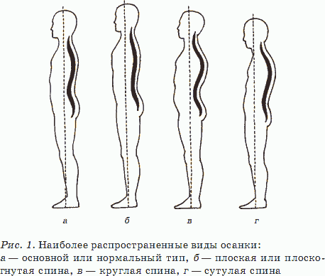 Пару слов в защиту корректоров осанки - 1