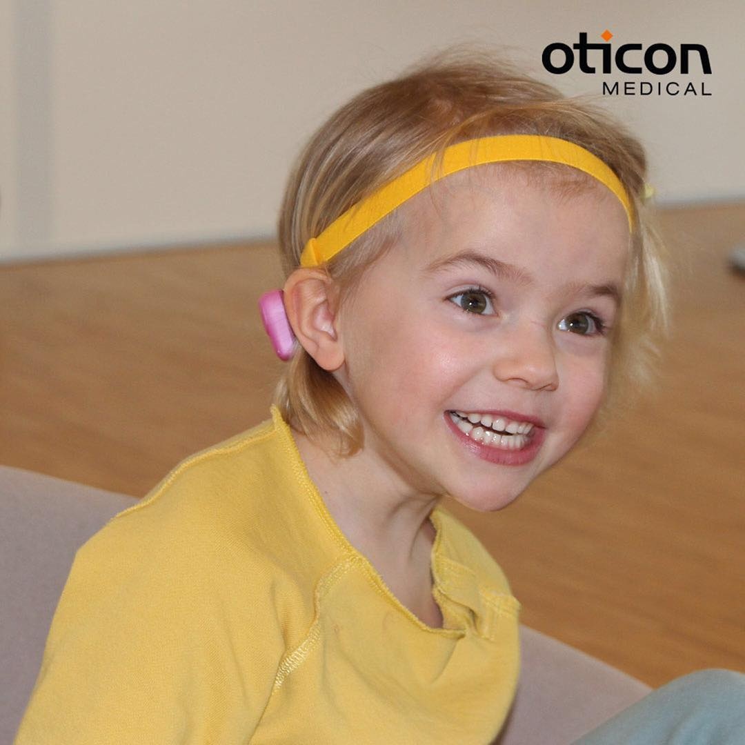 Oticon представили неимплантируемый слуховой аппарат для детей на базе технологии костной проводимости - 1