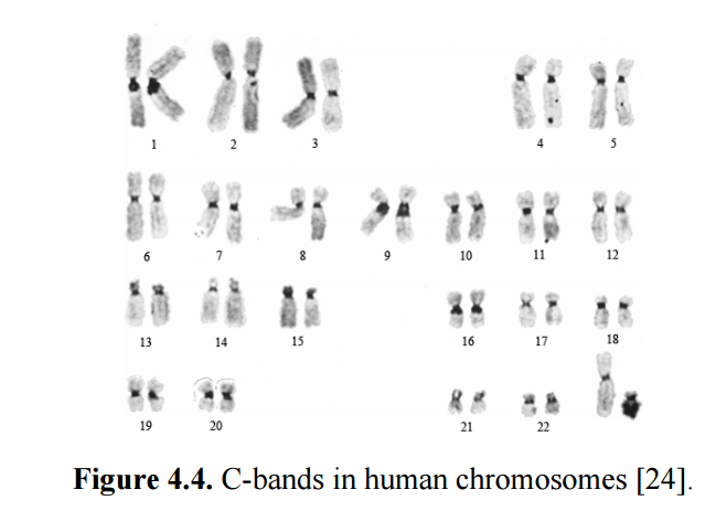 Хромосома-Yбийца, или почему мужчины умирают раньше? - 4