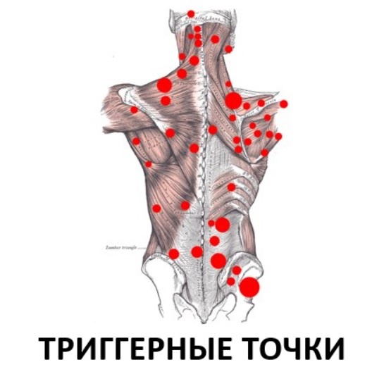 Программирование нервной системы человека. Триггерные точки - 1