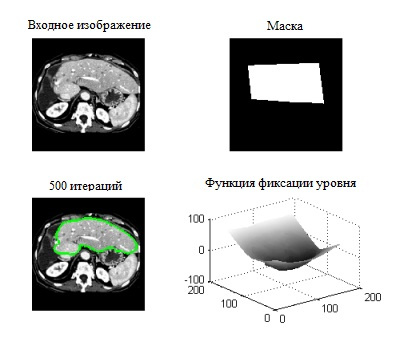 Бинарная сегментация изображений методом фиксации уровня (Level set method) - 6