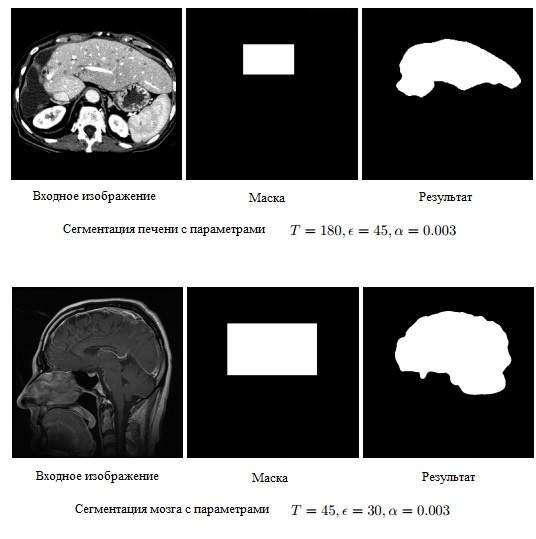 Бинарная сегментация изображений методом фиксации уровня (Level set method) - 7 Бинарная сегментация изображений методом фиксации уровня (Level set method) - 7